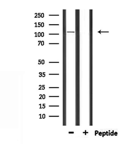MYO1A Antibody