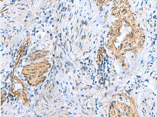 NMU / Neuromedin U Antibody