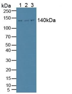 PLCB1 / Phospholipase C Beta 1 Antibody (aa316-476)