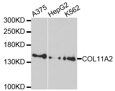 Polyclonal Rabbit anti-Human COL11A2 / Collagen XI Antibody (WB)