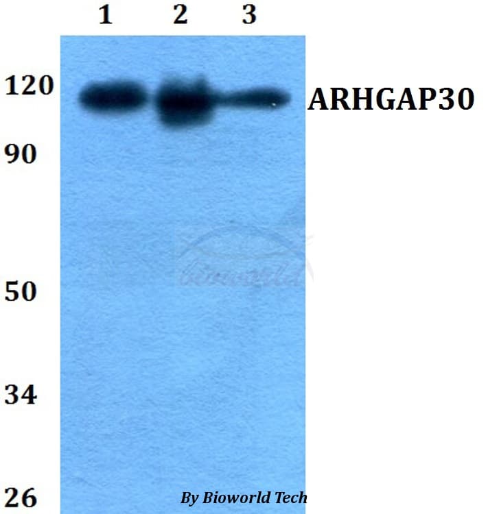 ARHGAP30 Antibody