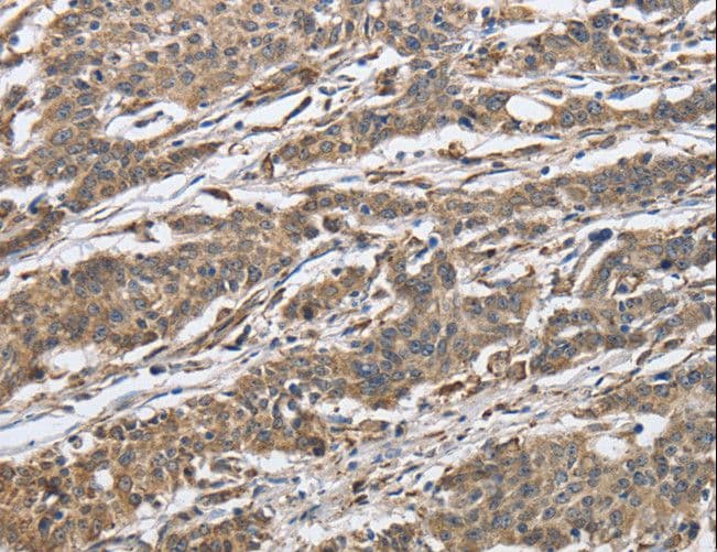 IPO7 / RANBP7 Antibody