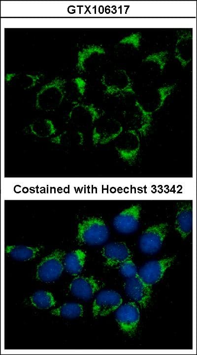 Polyclonal Rabbit anti-Human IFT74 / CCDC2 Antibody (aa538-600, WB)
