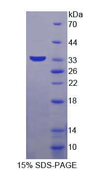 Mouse AQP9 / Aquaporin 9 Protein (Recombinant His, N-Terminal)
