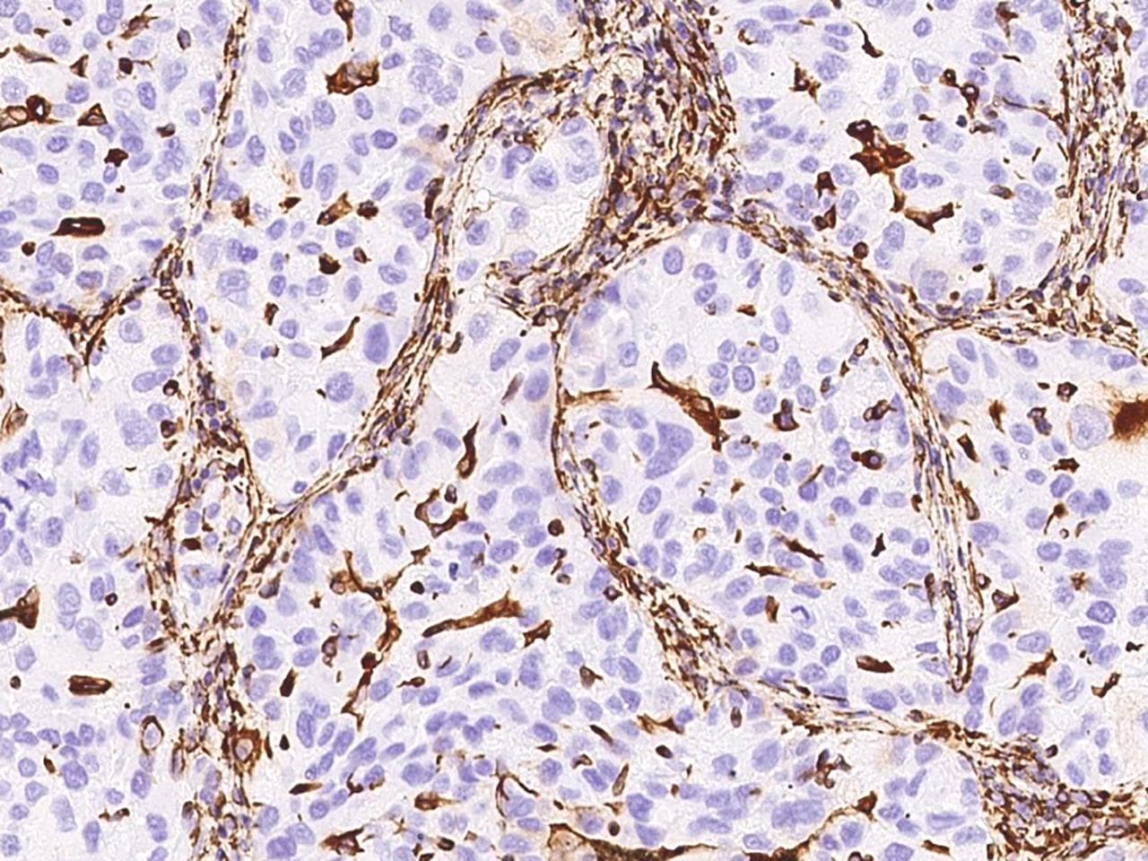Vimentin Antibody (clone 001, Preservative Free)