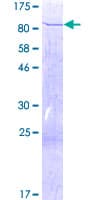 Human ACADVL Protein (Recombinant GST)
