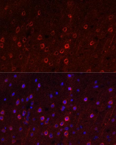 SLC1A1 / EAAT3 Antibody