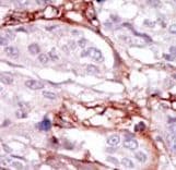STK31 Antibody (aa32-62)