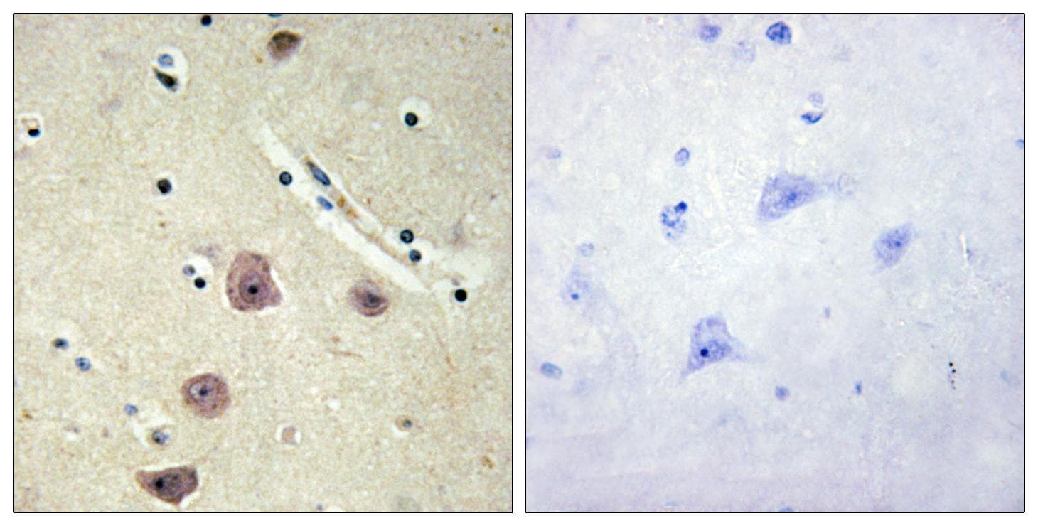 Polyclonal Rabbit anti-Human AK5 / Adenylate Kinase 5 Antibody (IHC)