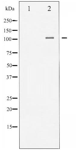 NFKB1 / NF-Kappa-B Antibody (phospho-Ser893)