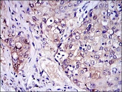IRAK4 / IRAK-4 Antibody (clone 2H9)