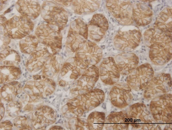 SGK2 Antibody (clone 1G11)