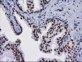 CTDSP1 / SCP1 Antibody (clone OTI1B6)
