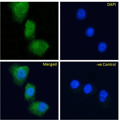 GPR119 Antibody (Glucose-dependent insulinotropic Receptor, clone Gipg013)