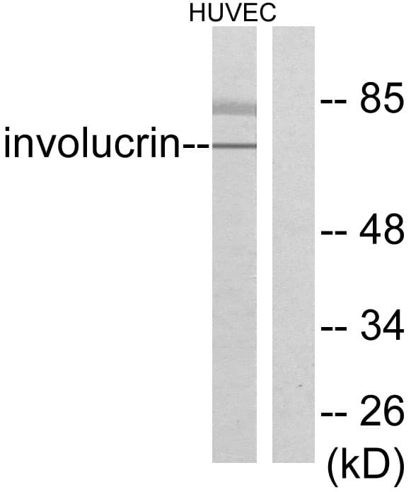 IHC-plus™ Polyclonal Rabbit anti-Human IVL / Involucrin Antibody (aa536-585, IHC, WB)