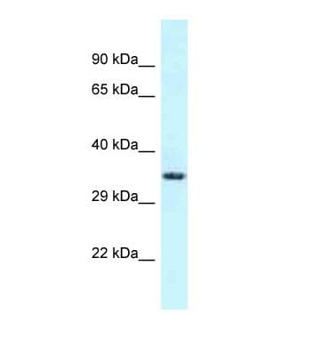 FSD1L Antibody (C-Terminus)