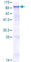 Human STS / ASC / Steroid Sulfatase Protein (Recombinant GST)