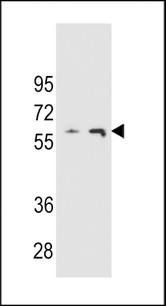 THUMPD3 Antibody (aa194-223)