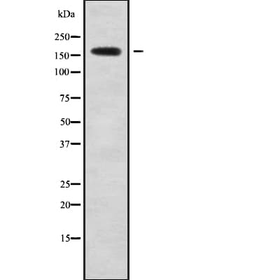 ABCC6 / MRP6 Antibody