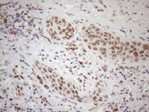 SRSF9 / SFRS9 Antibody (clone OTI5A12)