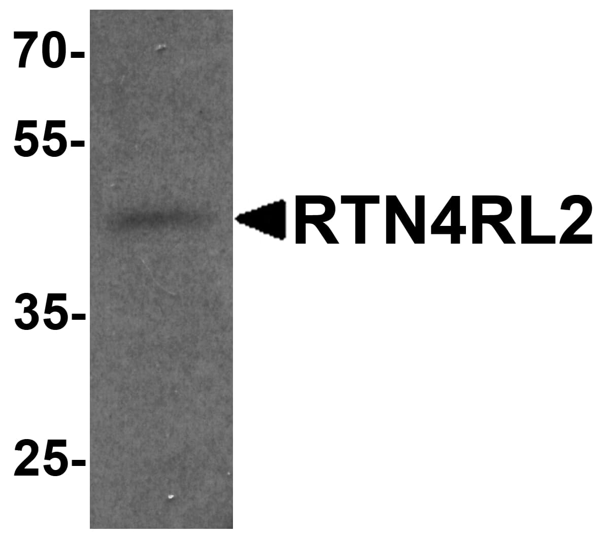 PathPlus™ RTN4RL2 Antibody