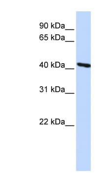 TMOD3 / Tropomodulin 3 Antibody (aa144-193)