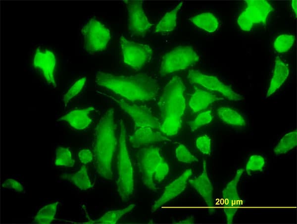 PRKCA / PKC-Alpha Antibody (clone 2F11)