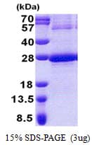 Human NDUFB9 Protein (Recombinant His)
