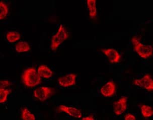 OR4C12 Antibody