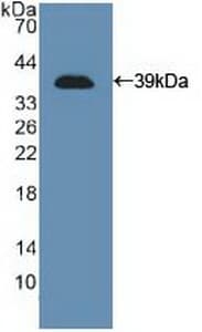 NCAM / CD56 Antibody (aa340-608)