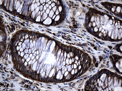 MED28 / Magicin Antibody (clone OTI10C8)