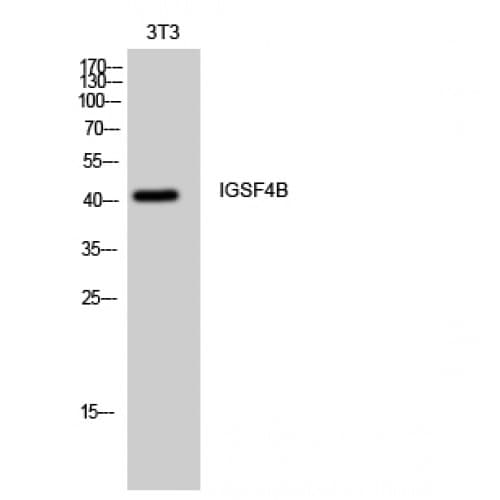 Polyclonal Rabbit anti-Human NECL-1 / CADM3 Antibody (110-190 aa, Internal, IHC, IF, WB)