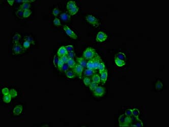 PRNP / PrP / Prion Antibody