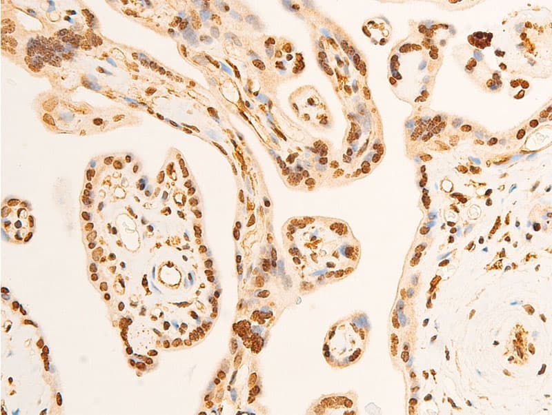 Polyclonal Rabbit anti-Human EIF2S1 Antibody (phospho-Ser51, IHC, IF, WB)