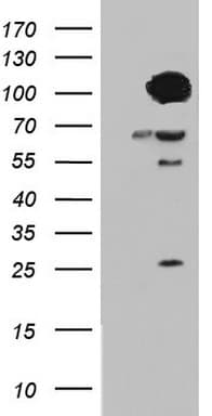 BFSP1 / Filensin Antibody (aa405-665, clone OTI2D2)