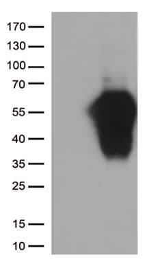 HAVCR2 / TIM-3 Antibody (clone OTI12C5)
