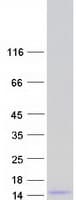 Human SMR3B Protein (Recombinant Myc-DDK (Flag))