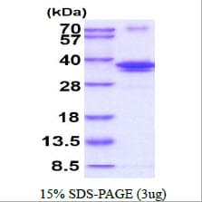 Human POLL / DNA Polymerase Lambda Protein (Recombinant His)