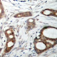 ATM Antibody (Internal)