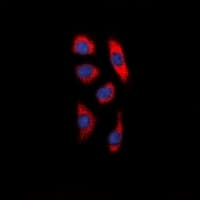 SMIF / DCP1A Antibody (Internal)