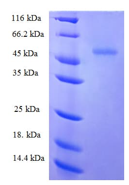 Human ZRANB2 / ZNF265 Protein (Recombinant His-SUMO)