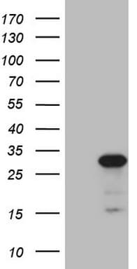 ABCC5 / MRP5 Antibody (clone OTI2C8)