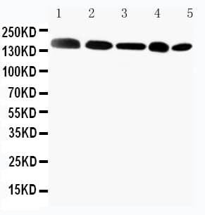 GLI2 Antibody (aa1444-1463)