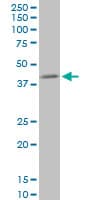 PPP1R8 / Rnase E Antibody (clone 1G11)