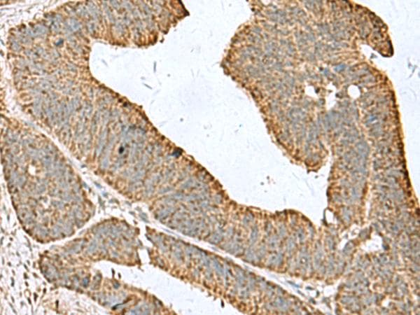 CDC20 Antibody
