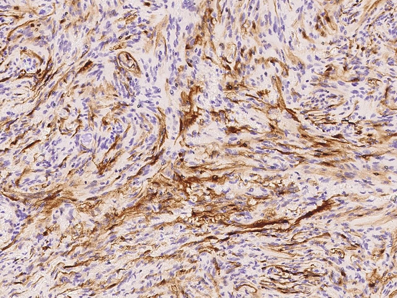 S100B / S100 Beta Antibody (clone 034, Preservative Free)