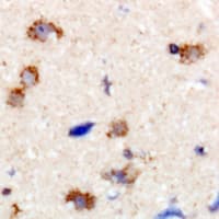 Polyclonal Rabbit anti-Human DNM1 / Dynamin Antibody (C-Terminus, IHC, WB)