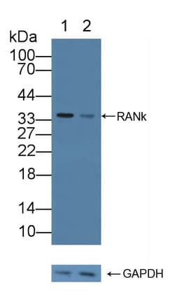 TNFRSF11A / RANK Antibody (aa330-615)