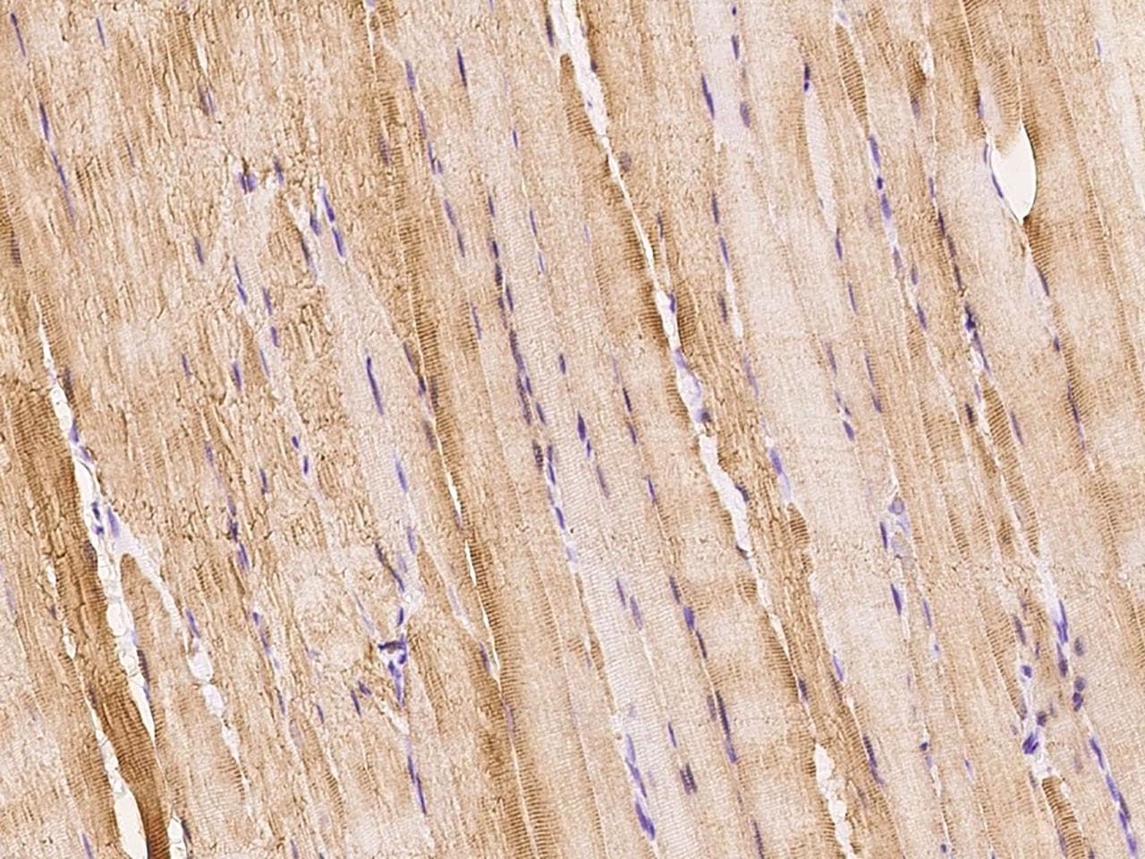CKM / Creatine Kinase MM Antibody (Preservative Free)