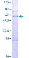 Human RBM38 Protein (Recombinant GST)